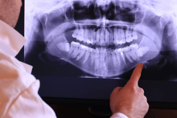 Best Emergency Gum Treatment in Burnsville, MN